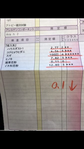 花粉症